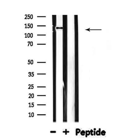 MOV10L1 Antibody