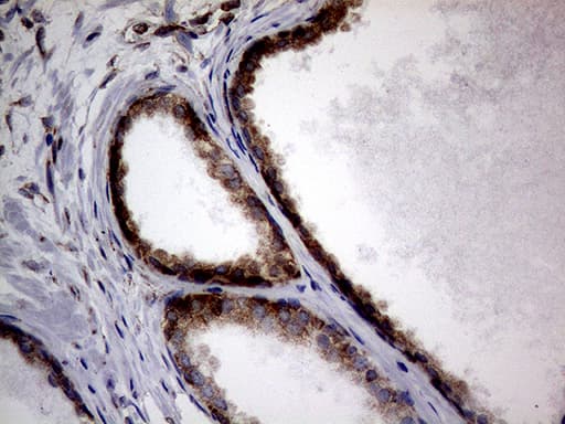 Monoclonal Mouse anti-Human DIRAS2 Antibody (clone OTI8A5, aa1-196, IHC, WB)