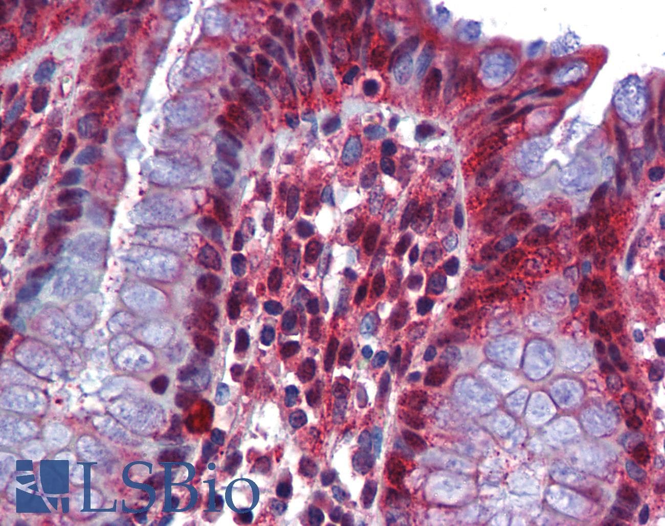 RBM47 Antibody (aa287-336)