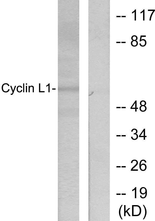 Polyclonal Rabbit anti-Human CCNL1 / Cyclin L1 Antibody (aa461-510, IHC, WB)