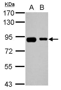 EPS8L2 Antibody