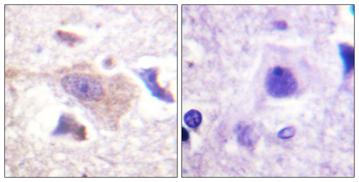 GRB10 Antibody (aa33-82)