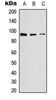 Polyclonal Rabbit anti-Human SELP / P-Selectin / CD62P Antibody (N-Terminus, WB)