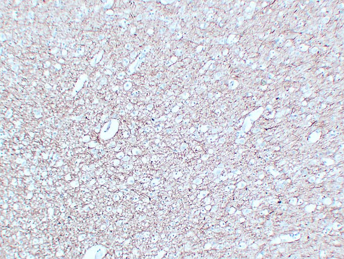 NF-L / NEFL Antibody (clone ABT-NF)
