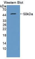IFN Beta / Interferon Beta Antibody