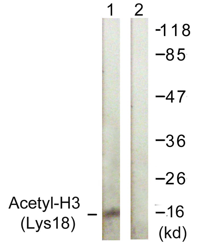 IHC-plus™ Histone H3 Antibody (Acetyl-Lys18)