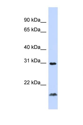 TNFSF14 / LIGHT Antibody (C-Terminus)
