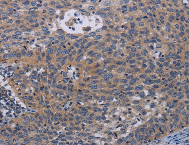 IHC-plus™ Polyclonal Rabbit anti-Human PAPPA / PAPP-A Antibody (IHC)