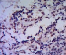 HSP70 / Heat Shock Protein 70 Antibody (clone 5A6)