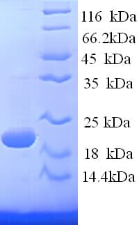 Sheep IFN Gamma / Interferon Gamma Protein (Recombinant His)
