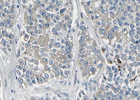 Polyclonal Rabbit anti-Human KCNMA1 / BK Antibody (IHC, WB)