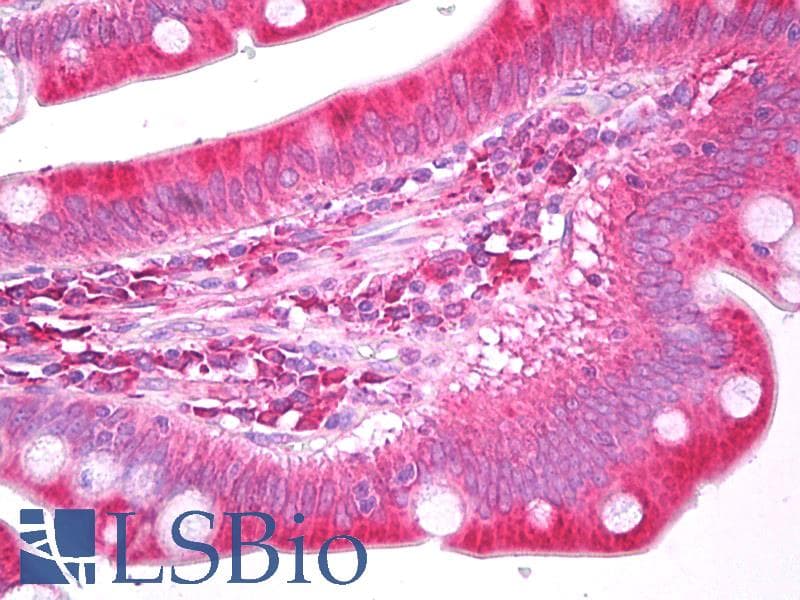 IHC-plus™ PDI / P4HB Antibody