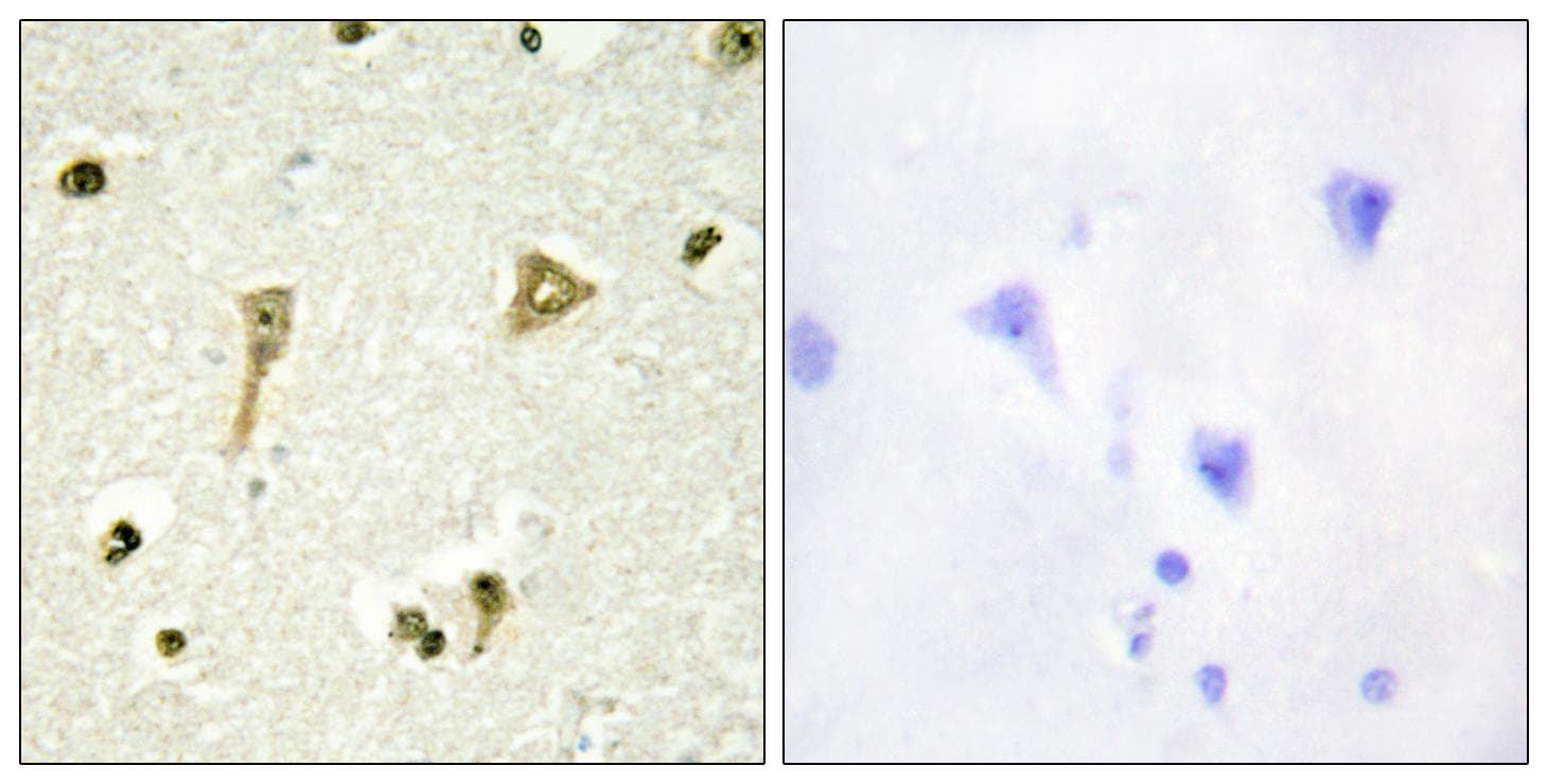 TSC22D1 / TSC22 Antibody