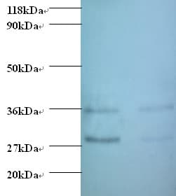 TGFA / TGF Alpha Antibody (HRP)