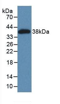 Human MAGP / MFAP2 Protein (Recombinant His, N-Terminal)