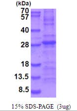 Mouse IL34 Protein (Recombinant His)