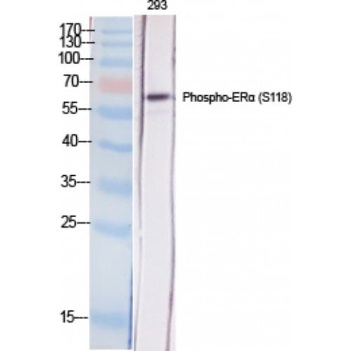 ER Alpha / Estrogen Receptor Antibody (60-140 aa)