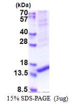 Human ARMS2 Protein (Recombinant His)