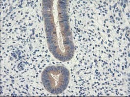 EIF2B3 Antibody (clone OTI1A4)