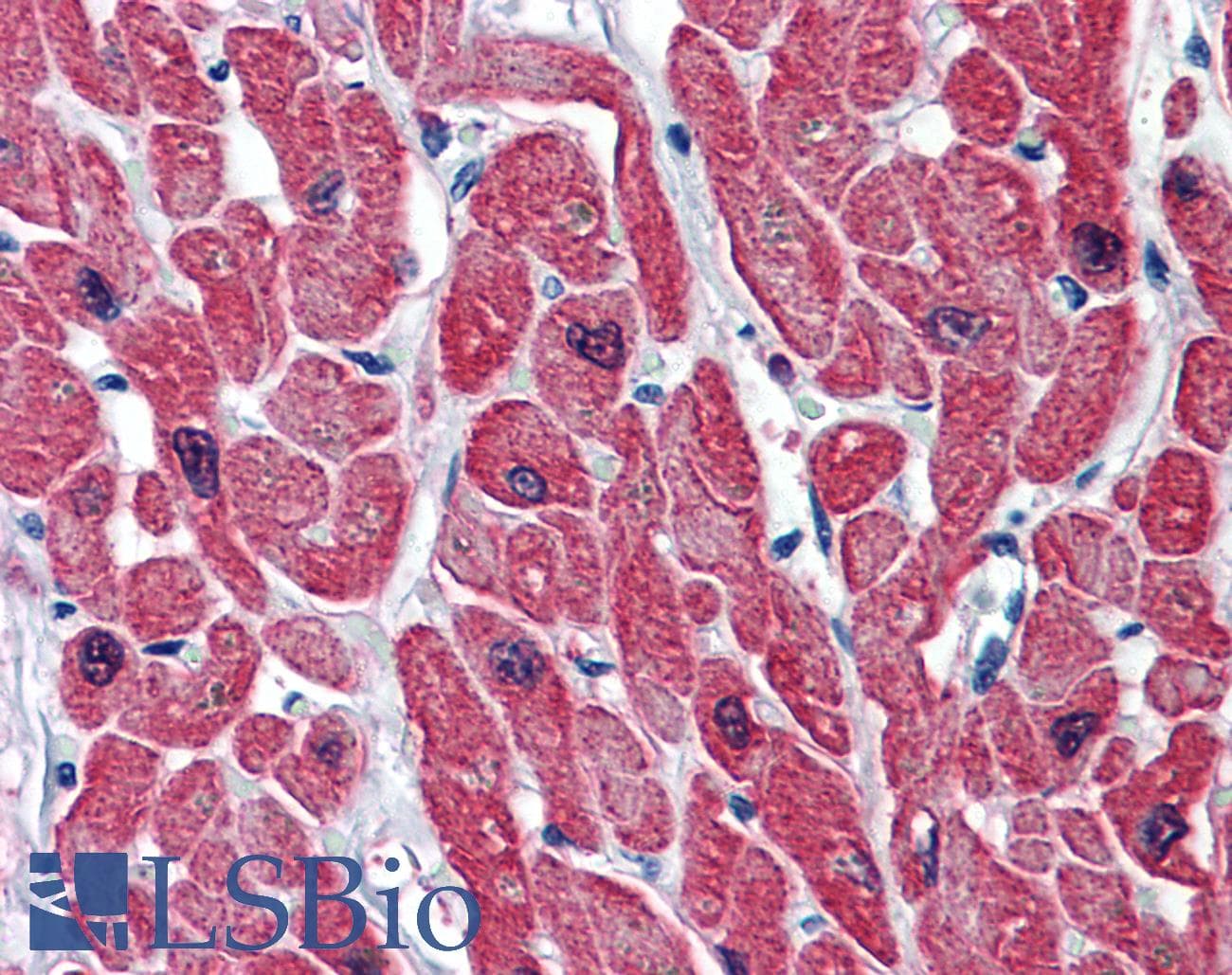 IHC-plus™ Monoclonal Mouse anti-Human TNNI3 / Cardiac Troponin I Antibody (clone 1E7, IHC, IF, WB)