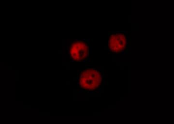 LMNA / Lamin A+C Antibody