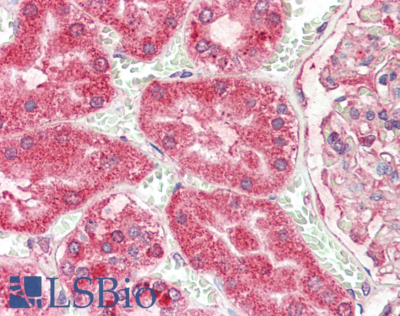 IHC-plus™ Angiogenin / ANG Antibody
