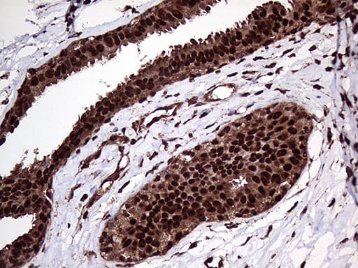 Monoclonal Mouse anti-Human PPP4C Antibody (clone OTI2H7, Carrier-free, IHC, WB)