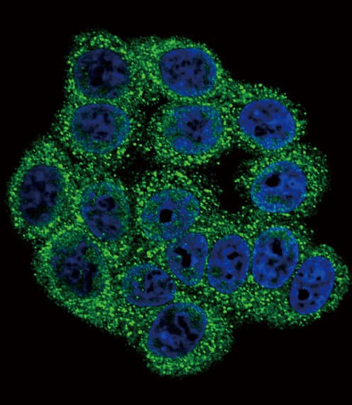 Polyclonal Rabbit anti-Human INHA / Inhibin Alpha Antibody (aa79-108, IHC, IF, WB)