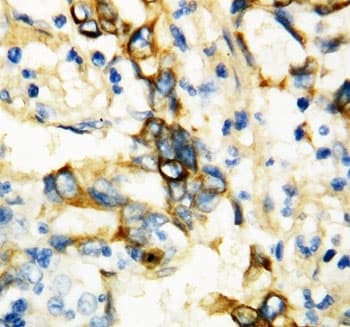 TNFRSF1A / TNFR1 Antibody (aa195-211)