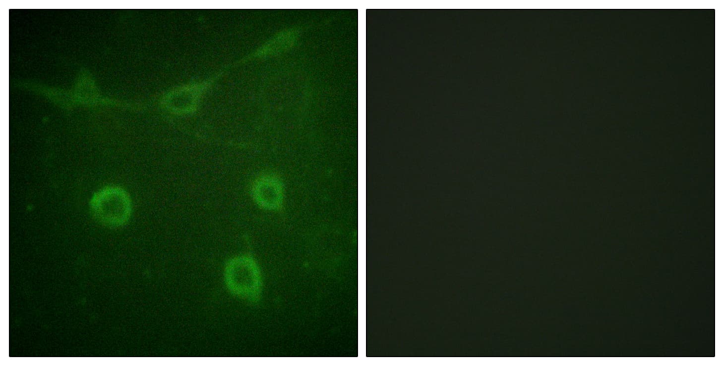 NTRK1 / TrkA Antibody (phospho-Tyr496)