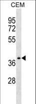 NDRG4 Antibody (aa193-220)