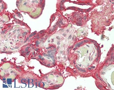 IHC-plus™ Polyclonal Rabbit anti-Human RPL3 / Ribosomal Protein L3 Antibody (IHC, WB)