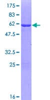 Human MPST Protein (Recombinant GST)
