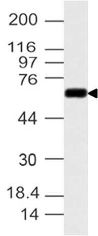 CYP1B1 Antibody (aa1-260)