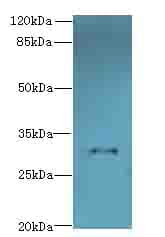 Polyclonal Rabbit anti-Human TMEM53 Antibody (IHC, WB)