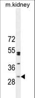 Polyclonal Rabbit anti-Human C6orf62 Antibody (aa118-147, IHC, WB)