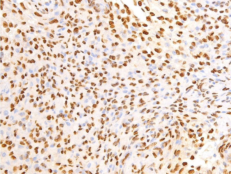 EGFR Antibody (phospho-Ser695)