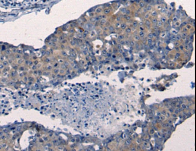 Polyclonal Rabbit anti-Human FGF2 / Basic FGF Antibody (IHC)