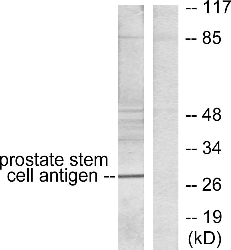 IHC-plus™ Polyclonal Rabbit anti-Human PSCA Antibody (aa41-90, IHC, WB)