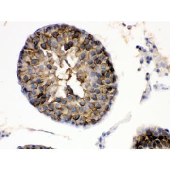 HSP90AA1 / Hsp90 Alpha A1 Antibody (aa454-488)