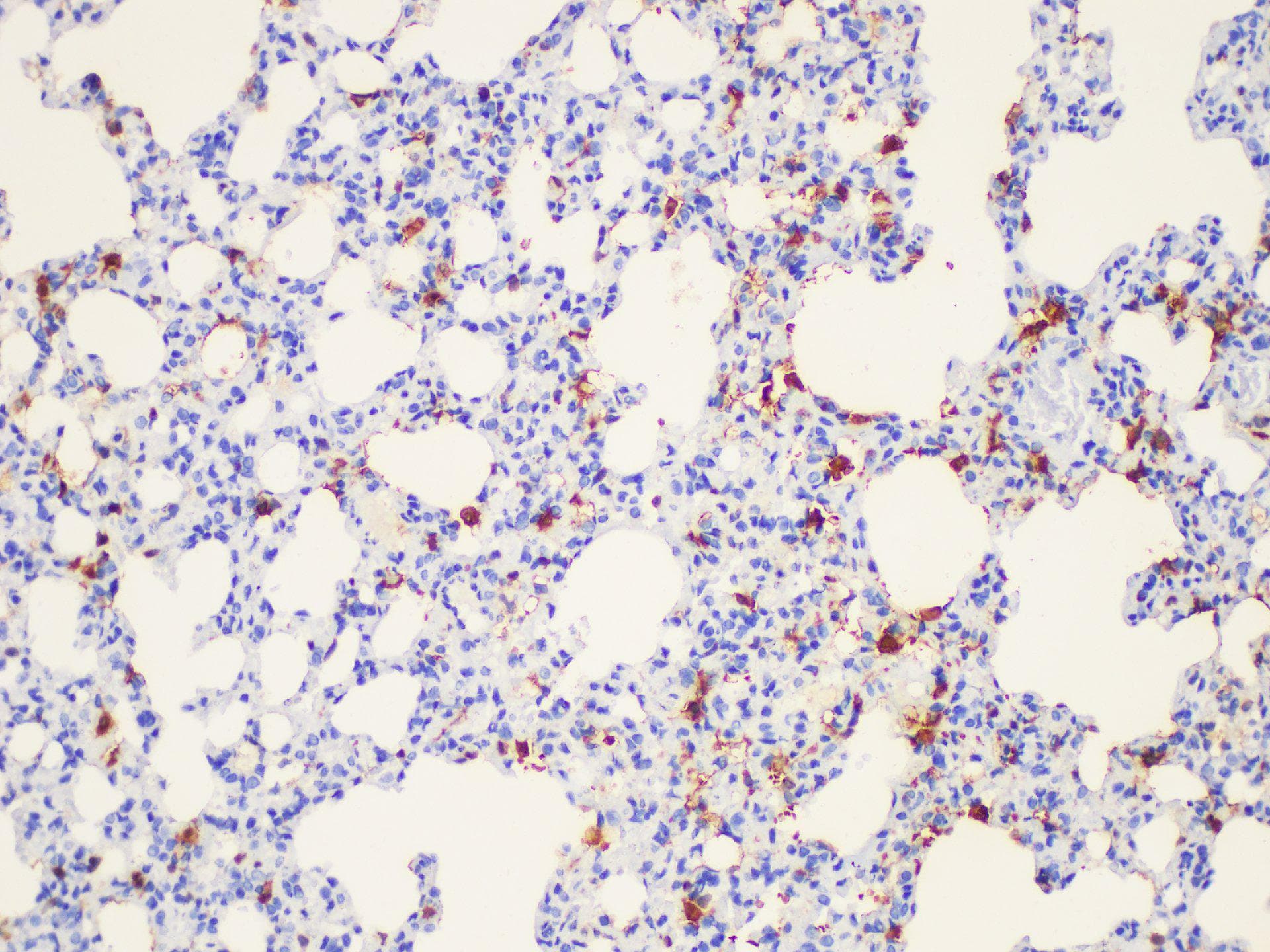 LGALS3 / Galectin 3 Antibody