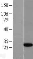 GINS4 / SLD5 Protein (Over-Expression Lysate Myc-DDK (Flag))