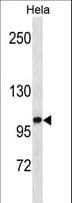 Polyclonal Rabbit anti-Human ZHX1 Antibody (aa771-800, WB)