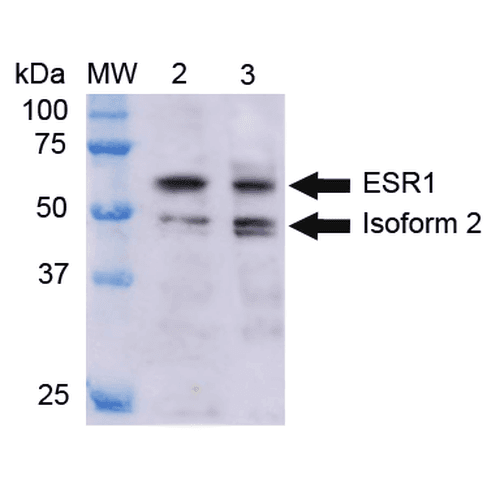 ER Alpha / Estrogen Receptor Antibody (Biotin)