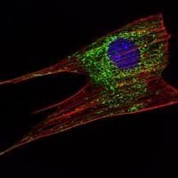 Monoclonal Mouse anti-Human KLHL11 Antibody (clone 1B9C1, IHC, IF, WB)