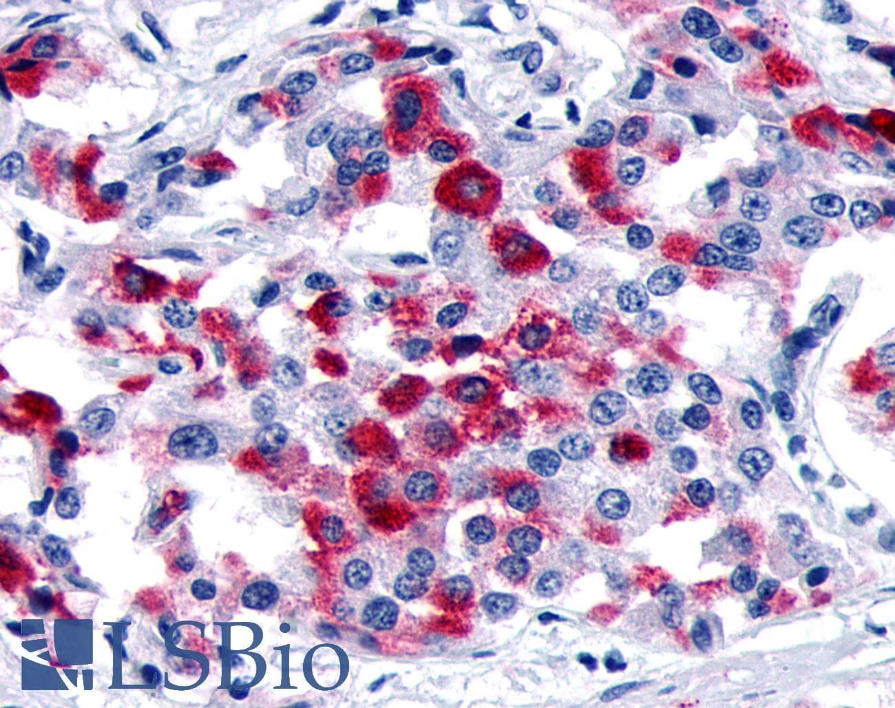 IHC-plus™ MC1R Antibody (Cytoplasmic Domain)
