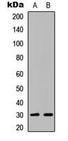 ATF5 Antibody (C-Terminus)