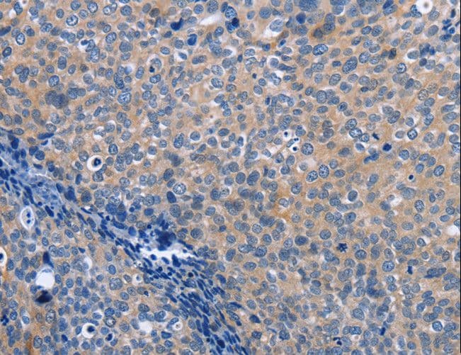 Latexin / MUM Antibody