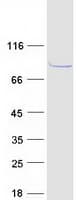 Human CABS1 Protein (Recombinant Myc-DDK (Flag))