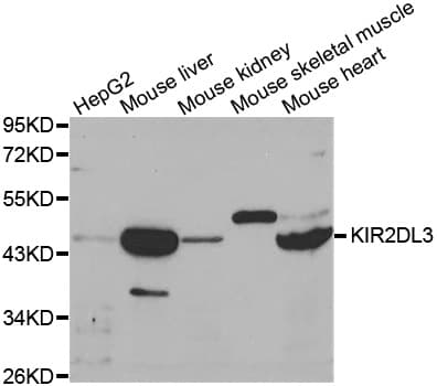 Polyclonal Rabbit anti-Human KIR2DL3 / CD152B2 Antibody (IHC, IF, WB)